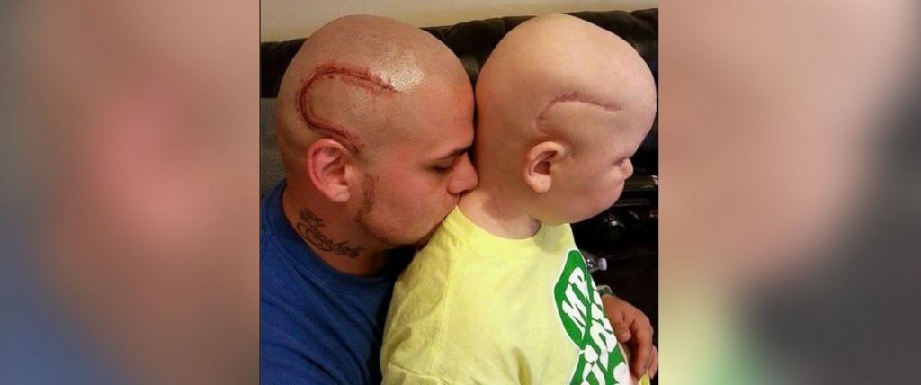 HT josh marshall scar tattoo