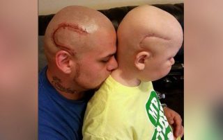 HT josh marshall scar tattoo