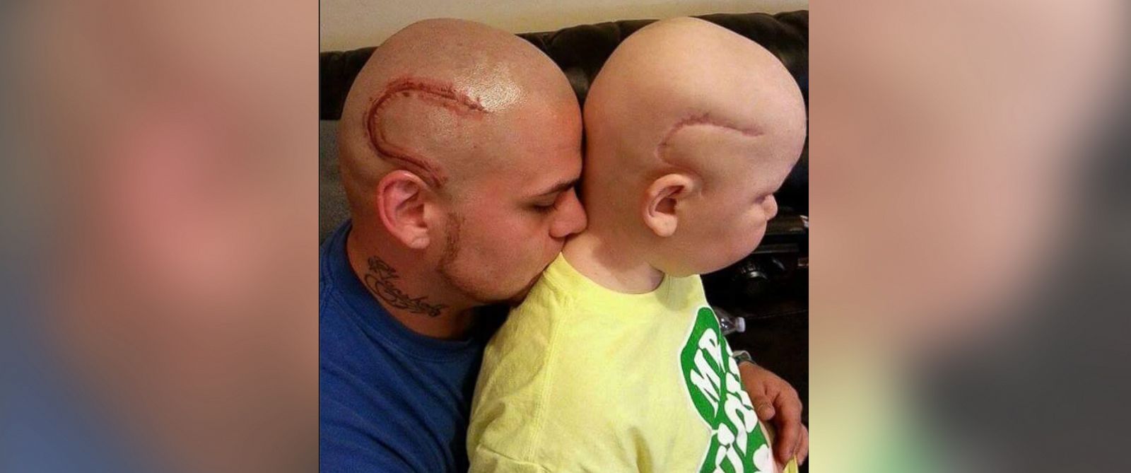 HT josh marshall scar tattoo